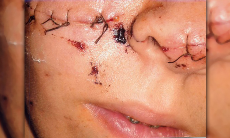 بَشاعة الصـورة أحيانـًا تُغنيك عَن مَعْرفَـةِ تَفـاصيل الإعتـداء..!!