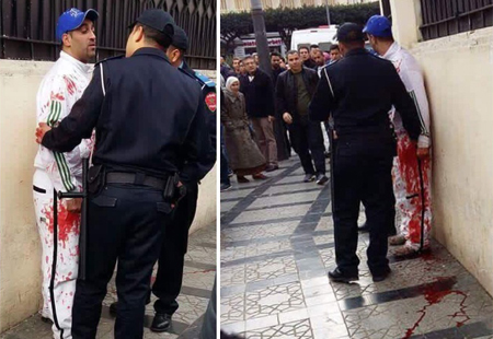 باب قنصلية فرنسا: نِزاع بالأسلحة البيضاء كادَ يُزهق حياة المدعو “حسن كليمات”