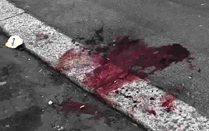 شجار بباب سبتة يؤدي لطلق ناري وإصابة ثلاثة أشخاص