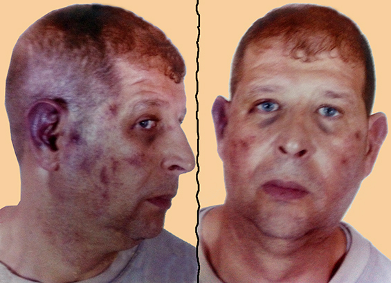 مواطن معتدى عليه.. يتابع شكايته ضد خصميه منذ ثمانية أشهر!؟